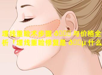 埋线重睑术步骤 🐞 与价格全解析「埋线重睑修复是 🐵 什么意思」